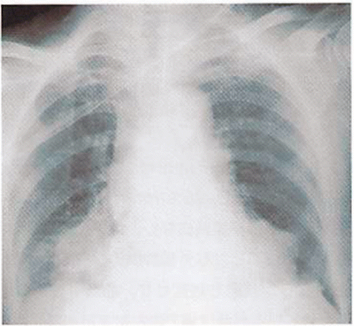 Figure A.4. Chest X-ray (case 5).