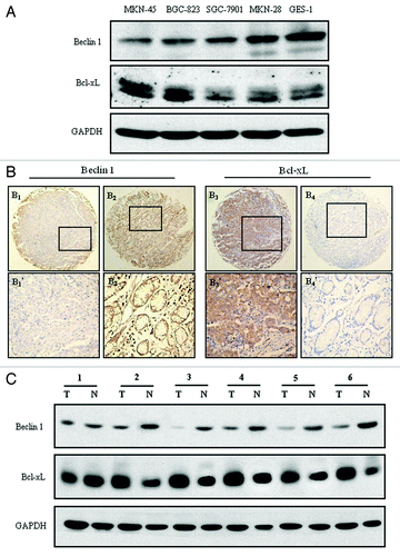 Figure 1. Beclin 1 and Bcl-xL expression in gastric cancer cell lines and tissues. (A) Western blot analysis of Beclin 1 and Bcl-xL expression in four gastric cancer cell lines (MKN-45, BGC-823, SGC-7901 and MKN-28) and a normal gastric mucosa epithelial cell line (GES-1). Equal loading of protein was determined by GAPDH. (B) Immunohistochemical staining for Beclin 1 and Bcl-xL in gastric cancer and normal adjacent mucosal tissues: (B1) Beclin 1 was moderately expressed in gastric cancer tissue, (B2) and strong stained in paired normal adjacent mucosal tissue (100 × ); (B3) Bcl-xL was overexpressed in the cytoplasm in the gastric cancer tissue, (B4) and nearly negative expressed in paired normal mucosal tissues from the same case (100 × ). (B1’ and B2’) and (B3’ and B4’) demonstrated the higher magnification (400 × ) from the area of the box in (B1 and B2) and (B3 and B4) respectively. (C) Western blot analysis of Beclin 1 and Bcl-xL expression in representative primary gastric cancer tissues (T) and normal adjacent mucosal tissues (N). Equal loading of protein was determined by GAPDH.