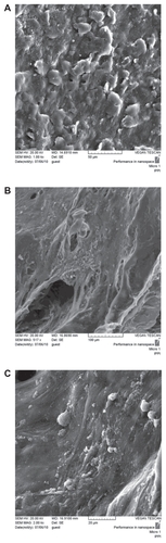 Figure 4 SEM of human fibroblasts on polyurethane scaffold after 7 days in culture (A) PUA1, (B) PUA2, (C) PUA3, The cells well attached on the samples.