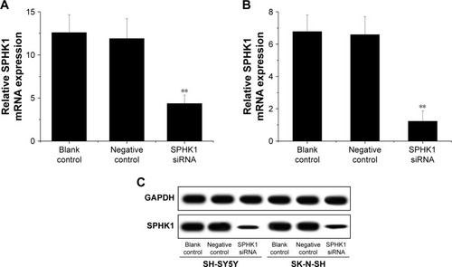 Figure 2 Effect of SPHK1 knockdown by siRNA on SPHK1 expression in SH-SY5Y and SK-N-SH cells.