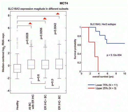 Figure 8 Informatics analysis of the transcriptional levels of MCT4 in human breast cancers. We used informatics analysis to determine whether the mRNA transcript for MCT4 is commonly upregulated in human breast cancer. (Left) Note that MCT4 (SLC16A3) is overexpressed in all types of breast cancer (relative to normal breast tissue), including both ER(+) and ER(−) cancer sub-types. (Right) In the HER2(+) sub-type, we observed an association with clinical outcome; increased MCT4 transcript levels were associated with decreased overall survival (N = 14 patients).