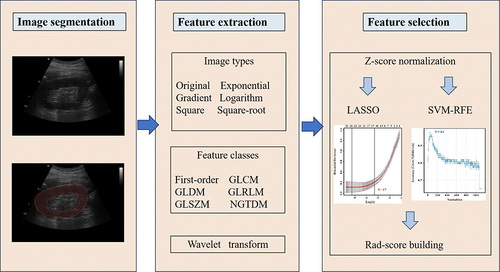 Figure 1 The workflow of the critical steps in constructing an ultrasound imaging-based rad-score for a patient with Type 2 diabetes.