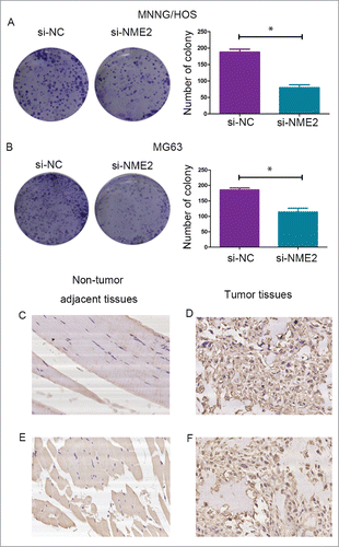 Figure 4. The clone forming assay showed that the number of colonies was significantly reduced when the expression of NME2 was knocked down in the MNNG/HOS (A) and MG63 (B) cell lines. (C) NME2 expression in adjacent non-tumor tissues (D) NME2 expression in tumor tissues (E) c-Myc expression in adjacent non-tumor tissues (F) c-Myc expression in tumor tissues. The tumor cells show cytoplasmic staining. All images were captured at 200 × magnification.