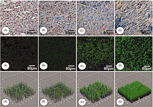 Figure 4. Cross section from wound area: (A) NCG group, (B) MG group, (C and D) 2 and 4% ZMEO-treated groups. Note well-formed collagen deposition in cross sections from ZMEO-treated animals on day 7 after wound induction (first row), which is significantly increased on day 14 after injury (second row). The third row represents the software analyze for collagen intensity. The cross sections from animals in ZMEO-treated groups exhibited condense collagen deposition versus NCG and MG groups. Masson-trichrome staining and fluorescent staining for collagen, 400× magnification.