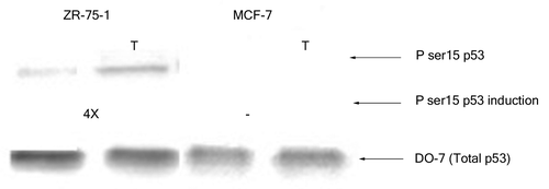 Figure 1. Streptavidin DNA binding assay with wild-type p53 from two cell lines. Aliquots of nuclear extracts from either MCF-7 cells (A) or ZR-75–1 cells (B and C) with or without treatment with 0.2 mM H2O2 for 3 h (H2O2) containing 50 pg of the p53 protein were reacted with 20 pmoles of biotinylated gene regulatory sequences (marked at the bottom of each panel) and DNA binding performed as described in Materials and Methods. The unbound (U) and bound (B) fractions from each reaction along with a pre-bound control (P) were loaded on an SDS-PAGE, transferred to a PVDF membrane and probed with DO-7 to determine the percent p53 bound to each sequence.