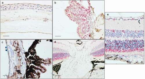 Figure 4. In situ hybridization staining (red dots) of Optn in cornea (a), ciliary body (b), trabecular meshwork with iridocorneal angle (c), optic nerve head (d), and retina (e). Sections are of pigmented (a, c, e) or albino mice (b, d). Scale bar: 50 µm for optic nerve, 25 µm for all other sections.