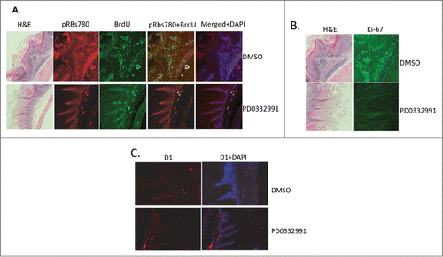 Figure 3. Immunufluorescence staining of fore stomach in PD0332991 versus vehicle control treated mice. (A) Phospho-Rb, ser-780 (pRBs780) and BrdU staining of fore stomach containing papilloma. (B) Total Rb and Ki-67 staining of papillomas from vehicle or PD0332991 treated mice. (C) Cyclin D1 staining of papillomas from vehicle or PD0332991 treated mice.