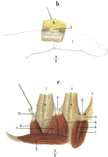 Figure 4. b. Index finger: 3: subcutaneous mucous bursa. c. 1–3: metacarpals II–IV; 8: intermetacarpophalangeal bursae.
