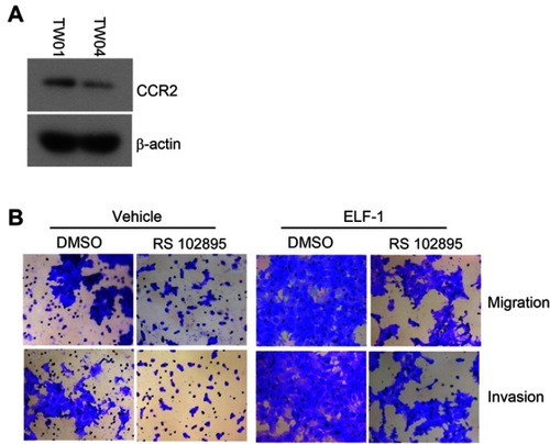 Figure S3 The CCL2 expression in NPC cell lines and the effects of CCR2 antagonist RS102895 on the migration, and invasion of gain-of-function of ELF-1-TW01 cells. (A) The protein level of CCR2 in TW01 and TW04 cells was estimated by Western blotting. (B) The images of migration and invasion of ELF-1-TW01-overexpressing and vehicle cells in the presence or absence of CCR2 antagonist RS102895 were assessed using Transwell assays.Abbreviations: CCL2, C-C motif chemokine ligand 2; CCR2, C-C chemokine receptor 2; NPC, nasopharyngeal carcinoma.