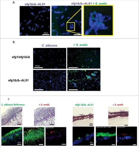 Figure 8. Overexpression of the ALS1 gene in the efg1Δ/Δ background partially rescues the cross-kingdom mucosal biofilm phenotype (A-B) Co-culture of a C. albicans ALS1-overexpressing strain in the efg1Δ/Δ background (efg1Δ/Δ-ALS1) with a teal protein expressing S. oralis 34 strain for 45 minutes. (A) or 24 hours (B) on Permanox® plastic chamber slides, in RPMI 10%FBS, 10%BHI media. Candida cells were stained with Calcofluor White (blue) and filamentation pattern and co-aggregation interactions were observed under a fluorescence microscope. A representative of 2 experiments is shown, with conditions set up in duplicate. Fungal-bacterial cell co-aggregation interactions were observed both in early (Fig. 8A) and late (Fig. 8B) stages of mixed biofilm development with the ALS1 overexpressing strain. Bars: 20 μm (A); 100 μm (B). (C) Sixteen-hour mucosal biofilms of C. albicans (left panels) or C. albicans with S. oralis (right panels). Biofilms of the reference strain and the efg1Δ/Δ-ALS1 overexpressing strain, with or without S. oralis 34, were grown on the surface of organotypic oral mucosal surfaces. H&E staining (top panels) and fluorescence images of biofilms labeled with a FITC-conjugated anti-Candida antibody (green), an Alexa Fluor 568-labeled streptococcal FISH probe for S. oralis (red), and counterstained with the nucleic acid stain Hoechst 33258 (blue) to visualize mucosal cells, are shown. Green and red channels are individually shown in the efg1Δ/Δ-ALS1 plus S. oralis panels to better visualize the fungal and bacterial signals. A representative of 2 experiments is shown, with conditions set up in duplicate. Overexpression of ALS1 in the efg1Δ/Δ strain background restored S. oralis biofilm to levels similar to the reference and efg1 revertant strains (see Fig. 5A for comparison to the revertant strain). Bars: 50 µm