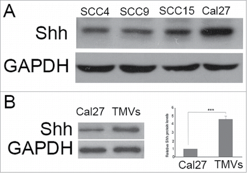 Figure 4. The expression of Shh in OSCC cell lines, Cal27 derived MVs A, the expression of Shh protein was detected in OSCC cell lines tested by western blot; B, western blot was used to detect the expression of Shh in Cal27 lysates and Cal27-derived MVs. A difference of P< 0.05 was considered significant.