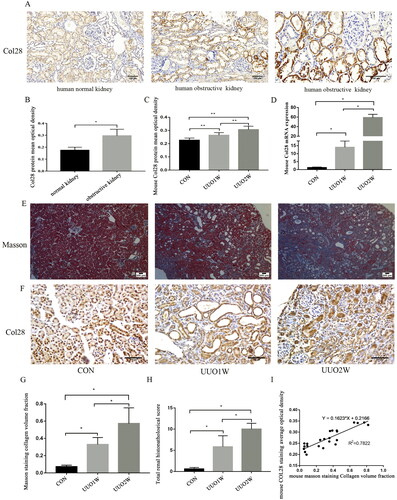 Figure 2. COL28 expression in human obstructive kidney tissue and mouse obstructive kidney tissue. Image of normal and obstructive renal tissue stained by COL28 immunohistochemistry (A). Bar = 100 µm. Quantification of the expression levels of COL28 proteins in normal and obstructive kidney tissues (B). Graphical representation of the protein (C) and mRNA (D) expression levels of COL28 in mouse control, UUO 1-week, and UUO 2-week groups. *p < 0.05, **p < 0.01. Image of mason (E) and COL28 immunohistochemistry staining (F) in the mouse control, UUO 1-week, and UUO 2-week groups. Bar = 200 µm. Total renal histopathological score (G) and Masson straining surface area (H) in the mouse control, UUO 1-week, and UUO 2-week groups. (I) Correlation between the total renal histopathological score and Masson straining surface area. *p < 0.05.