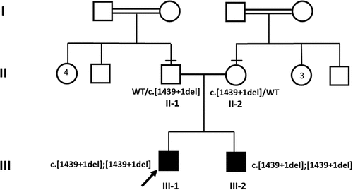 Figure 1. Pedigree and segregation analysis. Proband (III-1) and affected younger brother (III-2) are homozygous for splice-site variant in SCLT1 gene NM_144643.3: c.1439 + 1del while parents (II-1 and II-2) are heterozygous. The arrow depicts proband, horizontal lines—parents examined clinically. Black squares: affected male individuals. Double horizontal lines: consanguinity.