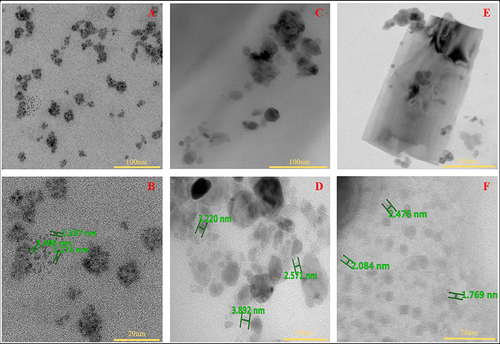 Figure 2 TEM images of nanocollagen study groups: (A and B) Pure NC, (C and D) NC + 0.005% GO, and (E and F) NC + 0.01% GO, respectively. Pure NC demonstrated free NC particles present within the sample, whereas the samples with GO displayed GO sheets with NC particle attached to it.