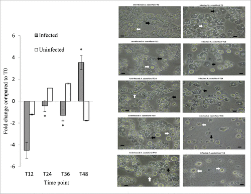 Figure 5. MCASP-1 expression during L. pneumophila grown in A. castellanii that carried change from trophozoites to cysts. Fold changes in the expression of MCASP-1 in A. castellanii were detected using quantitative RT-PCR every 12 hours from T0 to T48 (Left). The expression level of MCASP-1 was normalized to that of A. castellanii 18S rRNA gene. Data were expressed as the mean fold change. Error bars show the SEM (Standard error of the mean). Fold changes at T24 to T48 were statistically compared with the that at T12 using Wilcoxon signed rank test, asterisks (#) represent significant change (p < 0.05). The microscopic images (Right) show the morphologies of the uninfected and infected A. castellanii. Black arrows indicate trophozoites and white arrows indicate cyst forms that have two-layer cell wall (scale bar = 25 μm, magnification 400 ×).