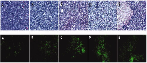 Figure 8. Paraffin section of tumor tissue with HE staining and Alexa Fluor 488 expression in tumor tissue observed under a fluorescence microscope.