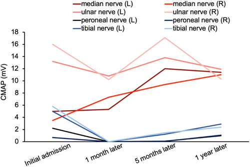 Figure 3 The changes of the nerves’ complex muscle action potential (CMAP) in patient with N2O intoxication. On initial admission, the patient developed severe symptoms and the CMAP of the peripheral nerve deteriorated rapidly. After stopping the exposure of N2O and high-dose vitamin B12 supplementation therapy, the CMAP of these nerves recovered gradually.