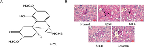 Figure 1 SH notably reduced the pathological manifestations in renal tissue of IgAN rats. (A) Chemical structure of SH. (B) Representative photographs of PAS staining of the kidney tissue (×400) of rats revealed differences between the treatment groups and the IgAN model group.