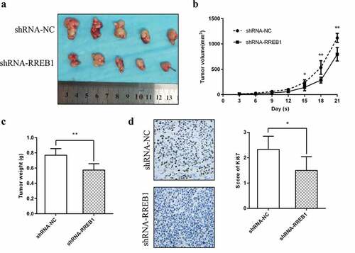 Figure 4. RREB1 promotes cell proliferation in vivo (n = 5)