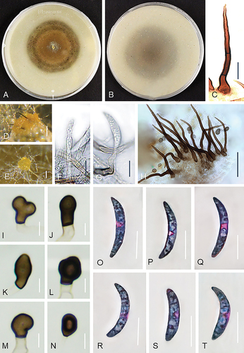 Figure 3. Colletotrichum caspicum (A–C, E, G, I–T from ex-holotype strain UTFC 365. D from strain UTFC 376. F, H from strain UTFC 373). A–B. Colony on OA after 7 d, A. upper and B. reverse side. C, H. Setae. D–E. Acervuli. F–G. Conidiophores. I–N. Appressoria. O–T. Conidia. C–H, O–T. from Anthriscus stem. I–N. from SNA. D, E. DM. C, F–T. DIC. Scale bars: D, E = 50 μm, C, F–T = 10 μm.