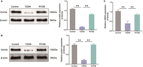 Figure 3 RYGB up-regulates Grin3a expression in white adipose tissue and arcuate nucleus of T2DM rats. (A and B) Western blot to measure the expression levels of Grin3a protein in white adipose tissue (A) and arcuate nucleus tissue (B) of rats in each group; (C) qRT-PCR to test the mRNA expression level of Grin3a in arcuate nucleus of rats. **P < 0.01.