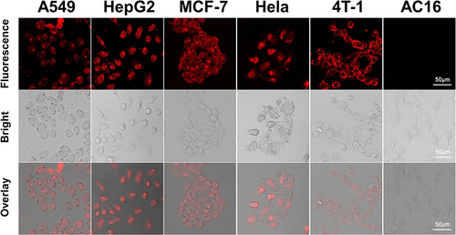 Figure 6 Cell imaging of A549, HepG2, MCF-7, HeLa, 4T-1 and AC16 incubated with Met-NHs-AuNCs for 2 hours.