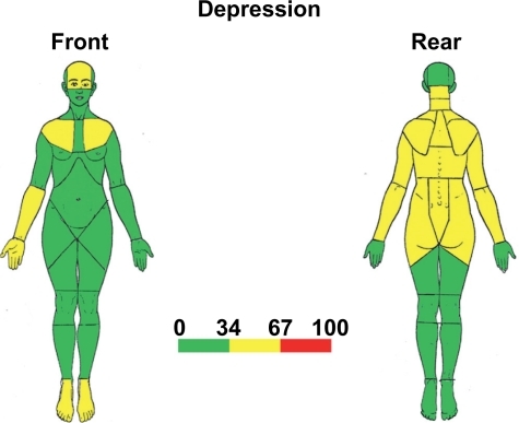 Figure 5 Percentage distribution of pain areas in patients with depression without somatic pain diagnoses (DE). See Figure 2.