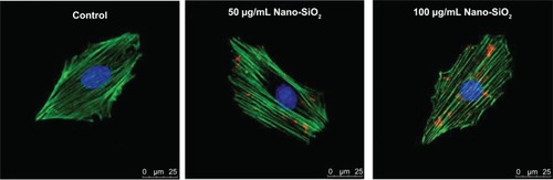 Figure 2 Subcellular localization of Nano-SiO2.Notes: LSCM images of HUVECs after incubation for 24 hours with red fluorescent-labeled Nano-SiO2 (50 μg/mL and 100 μg/mL). The cell skeleton is stained with Phalloidin-FITC (green), and the cell nucleus with DAPI (blue).Abbreviations: Nano-SiO2, silica nanoparticles; LSCM, laser scanning confocal microscope; HUVEC, human umbilical vein endothelial cells; FITC, fluorescein isothiocyanate; DAPI, 4,6-diamidino-2-phenylindole.