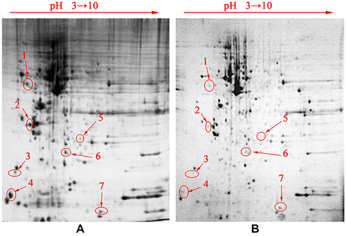 Figure 8 2-DE results of HepG2 cells from the control group (A) and SMC groups (B).