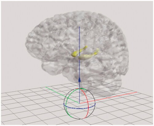 Figure 18. Adjusting position of the brain in Sketchfab.