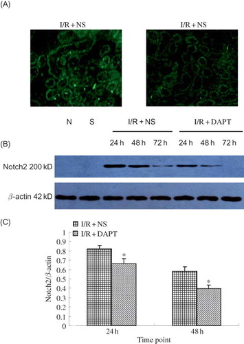 Figure 4. The expression of Notch2 protein (A–C): (A) The expression of Notch2 in the kidney at 24 h following IRI by immunofluorescence staining (original magnification ×400): renal IRI induced the increase of Notch2 protein expression in the renal tubules. DAPT treatment reduced the expression of Notch2 protein. (B) Immunoblot analysis of Notch2 protein at 24 h, 48 h, and 72 h of post-reperfusion, respectively. (C) The density of band was quantified. Values presented are ratio of Notch2 to β-actin, which was used as an equal protein loading marker. Results are presented as mean ± SEM (n = 5), *p < 0.05 versus respective IR + NS at the same time point.