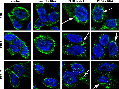 Figure 7.  Altered distribution of formyl peptide receptors after PLD1 and 2 siRNA transfection. After 96 h of post-transfection, HT29 cells were fixed and labelled with anti-FPR, FPRL1 and FPRL2 antibodies. Internalization of formyl peptide receptors was examined by fluorescence microscopy. Nuclear counterstaining (blue) was additionally used. The Figures show representative results from one of three independent experiments performed in duplicate. Scale bar: 20 µm. Published in colour in the online version.