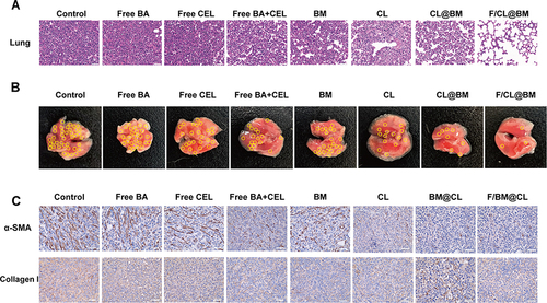 Figure 9 Effects of drug formulations on the tumor microenvironment in vivo. (A) Thin sections of lung were prepared on day 14 after injection and stained with hematoxylin-eosin. Scale bar, 50μm. (B) Representative photographs of lungs excised on day 14 after injection. Tumor nodule are circled in yellow. (C) Immunohistochemistry to detect α-SMA and collagen I in thin sections of lung like those in panel (A). Scale bar, 40μm. Data are mean ± SD (n = 5).