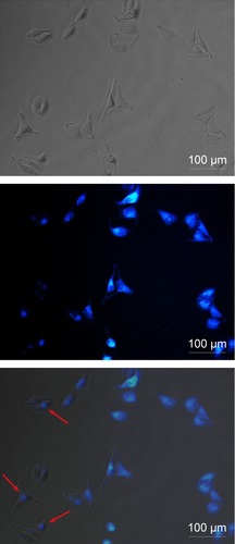 Figure 6 Microscopy images of HeLa cells after incubation with GQDs for 2 hours (from left to right, bright-field image, fluorescence image, and merged image). As indicated by the red arrows, the GQDs can penetrate into the nuclei.Abbreviation: GQDs, graphene quantum dots.