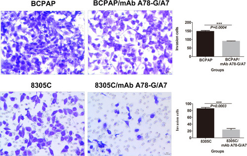 Figure 6 In vitro invasion assay of BCPAP and 8305C cells.Notes: TC cells, treated with or without mAb A78-G/A7, were examined in a transwell plate. Each cell line was divided into two groups that were treated with or without mAb A78-G/A7. The chamber was coated with Matrigel. BCPAP and 8305C cells on the membranes were stained with crystal violet (×100). Bar graphs below the stained invasion membranes show the results of the invasion assay, as analyzed using ImageJ software. Results are expressed as the pixel intensity of the scanned stained invasion membranes relative to negative controls. The horizontal coordinate represents the groupings, respectively are: BCPAP (papillary thyroid cancer cells) and BCPAP/mAb A78-G/A7 (BCPAP cells with mAb A78-G/A7 treated); 8305C (anaplastic thyroid cancer cells) and 8305C/mAb A78-G/A7 (8305C cells with mAb A78-G/A7 treated). The ordinate represents the invasion cells. Data=means±SEM. Relative to the blank control group, ***P<0.001.Abbreviation: mAb A78-G/A7, Thomsen–Friedenreich monoclonal antibody (A78-G/A7).