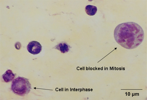Figure 1.  Mitotic blocked bone marrow cells versus interphase cells.