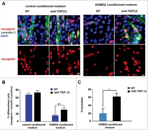 Figure 4. EDMD2 fibroblast medium inhibits differentiation of NHM through TGF β2. (A) Immunofluorescence staining of myogenin (red) and caveolin 3 (green) in C2C12 myoblasts cultured in presence of control or EDMD2 fibroblast medium. Data from samples left untreated (NT) or treated with anti-TGF β2 antibody (anti-TGF β2) are reported. Nuclei are counterstained with DAPI. Bar: 10µm. (B) Percentage of differentiated cells in C2C12 myoblast cultures conditioned by control or EDMD2 medium. Data from samples left untreated (NT) or treated with anti-TGF β2 antibody (anti-TGF β2) are reported. (C) Percentage of differentiated NHM conditioned by EDMD2 medium. Data from samples left untreated (NT) or treated with anti-TGF β2 antibody (anti-TGF β2) are reported. Means ± standard deviation are shown in graphs. Statistically significant differences are indicated by an asterisk (p<0.05) or double asterisk (p< 0.01).