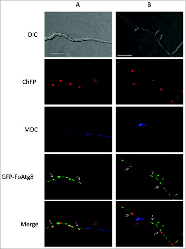 Figure 7. The GFP-FoAtg8 fusion protein disappears rapidly during autophagy-induced nuclear degradation. Micrographs showing hyphae of the GFP-FoAtg8 strain harboring H1-ChFP protein subjected to nitrogen starvation and stained with monodansylcadaverine (MDC). Note the absence of autophagosome-like structures (white arrows) in MDC-stained compartments containing either nondegraded (A) or degrading (B) nuclei (red arrows). Bars = 20 μm.