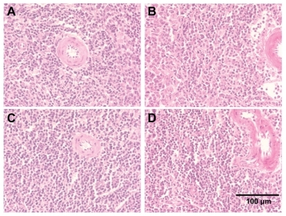 Figure 6 Cerium oxide nanoparticle exposure has no effect on the histological appearance of the spleen. (A) Saline control (400×), (B) CeO2 at 1.0 mg/kg (400×), (C) CeO2 3.5 mg/kg (400×), and (D) CeO2 7.0 mg/kg (400×).