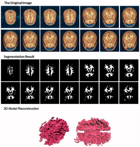 Figure 7. Front lobe image segmentation and 3D construction of American male virtual human.