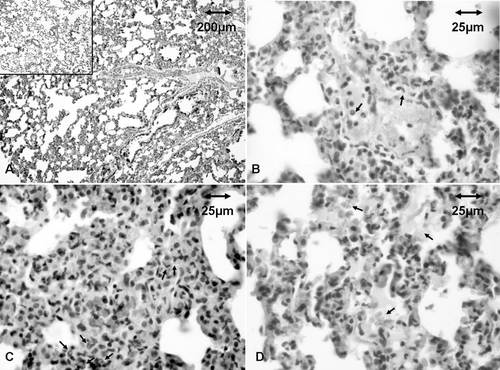 Figure 2.  Histology of lungs of rats that consumed warfarin. Representative samples from treated and control rats after 30 days of exposure. (a) Widened lung interstitium. Lungs of control rats are shown in insert. (b) Margination and transendothelial migration of neutrophils (arrows). (c) Neutrophils in interstitium (arrows). (d) Fresh erythrocytes and liquid in alveoli.