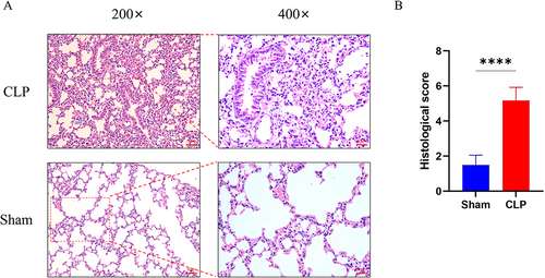Figure 8 Lung pathological change of mice. (A) Results of H&E staining of the lung tissues (Images were magnified at 200× and 400×, Scale bar = 50 μm). (B) Lung injury score of HE staining (n=3). Data are represented as the mean ± SD. ****P < 0.0001.