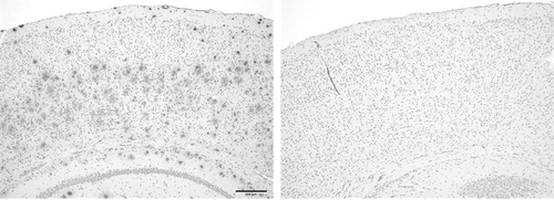 Figure 5. Beta-amyloid immunohistology of APP-PS1 transgenic (left) and control (right) mice.