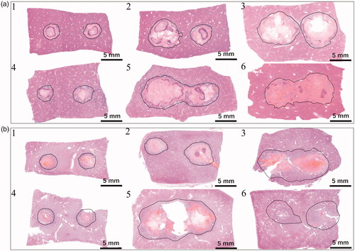 Figure 4. Representative images of ablation zones examined 72 h after treatments for (a) Liver and (b) kidney (the number on the figure denotes the protocol number).