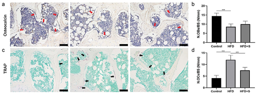 Figure 4. The intervention of simvastatin improves the imbalanced subchondral bone metabolism in HFD mice. (a) Representative OCN-stained sections with quantification of the (b) number of osteoblasts (N. OBs) on trabecular bone surface (BS) in tibia subchondral bone. (c) Representative TRAP-stained sections with quantitation of the (d) number of osteoclasts (N. OCs). Data are expressed as mean with 95% confidence interval. Bar = 100 μm. *P < .05; **P < .01; ***P < .001.