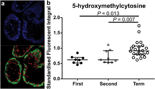 Figure 4. Immunofluorescent labelling of 4’,6-Diamidino-2’-phenylindole (DAPI; Blue, Nuclei), 5-hydroxymethycytosine (5-hmC; Red) and Pregnancy-specific beta-1-glycoprotein 1 (PSG-1; Green, syncytiotrophoblasts (STB)). (a). Representative image of PSG-1 and 5-hmC in a first-trimester placenta tissue section. (b). Quantification of 5-hmC in STB cells across gestation using laser scanning confocal microscopy showed a significant increase in 5-hmC staining intensity in term STBs compared to first and second trimester STBs. Data are median and interquartile range. Significance was determined using an ANOVA with Tukey post-hoc comparison.