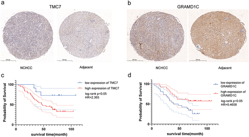 Figure 10 Immunohistochemical analysis of two genes in NCHCC tissues and corresponding tumor-adjacent tissues and the Kaplan-Meier curves of patients according to the expression of these two genes. (a and b) Immunohistochemical analysis of two genes in NCHCC tissues and corresponding tumor-adjacent tissues in TMA. (c and d) Kaplan-Meier analysis of overall survival of patients according to the expression of these two genes.