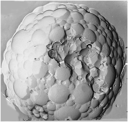 Figure 1 Scanning electron microscope image of DepoFoam® containing bupivacaine.Image supplied courtesy of Pacira Pharmaceuticals, Inc, 5 Sylvan Way, Parsippany, NJ 07054.