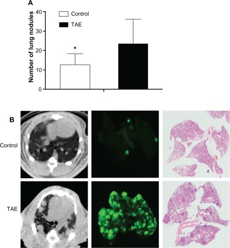 Figure 5 Lung metastasis was detected by the imaging system and further confirmed by histology examination.