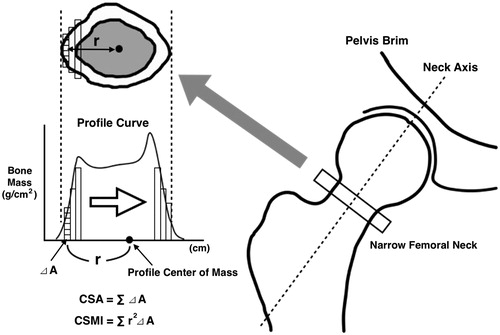 Figure 1. The targeted part of the advanced hip assessment is the narrowest part of the femoral neck. The cross-sectional area is calculated using a quadrature via the parts method of a small area (⊿A) for the area surrounded by a profile curve, which was obtained by dual-energy X-ray absorptiometry. The cross-sectional moment of inertia which surrounds the central axis and goes through the profile center of mass is calculated by summing the square of the distance (r) from ⊿A to the profile center of mass and the product of ⊿A across the entire area.